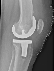 Thumb d4doc formularer upload 2014 11 kn c3 a6 20lat 20allo