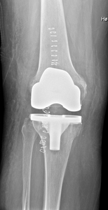 Thumb d4doc formularer upload 2016 11 kn c3 a6ap