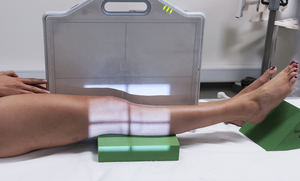 Thumb d4doc formularer upload 2014 11 kn c3 a6 20lat 20med 20horisontal